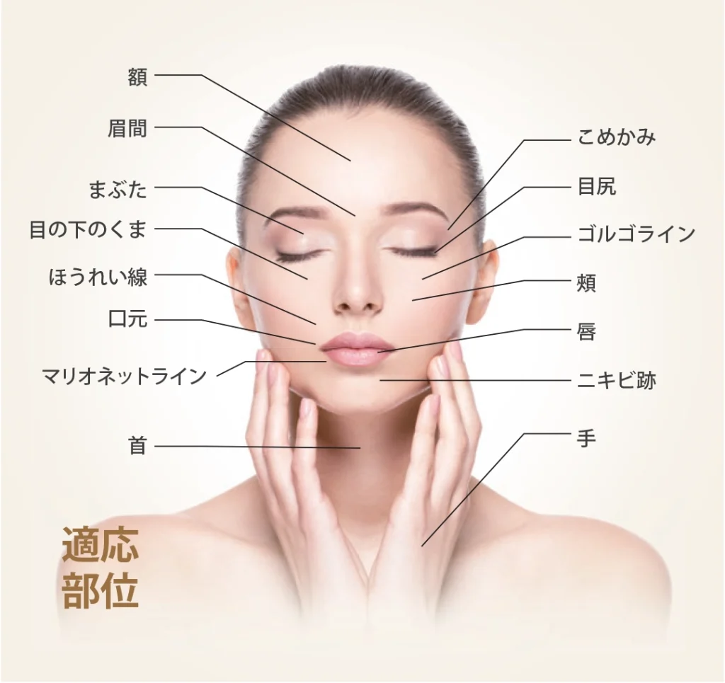 face wrinkles chart